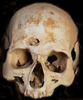 Обучение Чёрной Магии